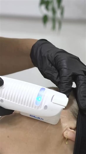 ✨ Why HIFU Is One of the Best Needle-Free Lifting Treatments ✨ If you’re looking for firmer, tighter, more lifted skin without injectables, HIFU (High-Intensity Focused Ultrasound) is one of the most effective options available. HIFU works by delivering focused ultrasound energy deep into the skin, stimulating collagen production exactly where it’s needed — the same layer targeted during surgical facelifts. ✨ The benefits of HIFU: 💫 Lifts and tightens sagging skin 💫 Defines the jawline and red