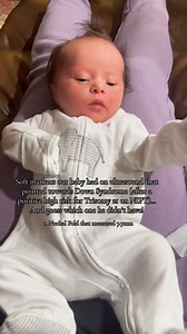 When we had Sheps 19 week anatomy scan, I am pretty sure I held my breath for as long as I could. I watched the ultrasound like I was diagnosing him, trying to pick up on every detail I could. After the scan, we met with the maternal fetal medicine doctor and I will never forget how compassionate she was. She was simply amazing at breaking the news to us (that we already knew based on NIPT). But hearing the words, “soft markers” made my heart sink. I knew had some, but speaking of them outloud i