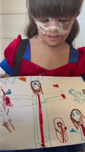 Preparing for Tissue Expansion: 2 Weeks Until the Balloons! 🎈🩹