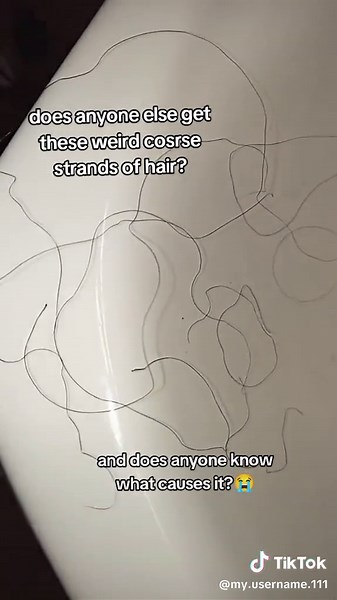 Dealing with Random Coarse Wirey Hair: Causes and Solutions