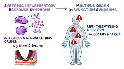 Video: Multiple organ dysfunction syndrome (MODS): Clinical sciences - Video Explanation! | Osmosis | Osmosis