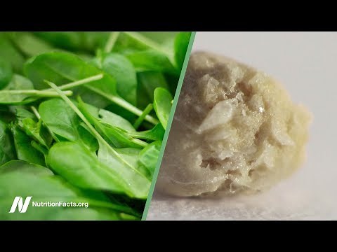 Oxalates in Spinach and Kidney Stones Should We Be Concerned?