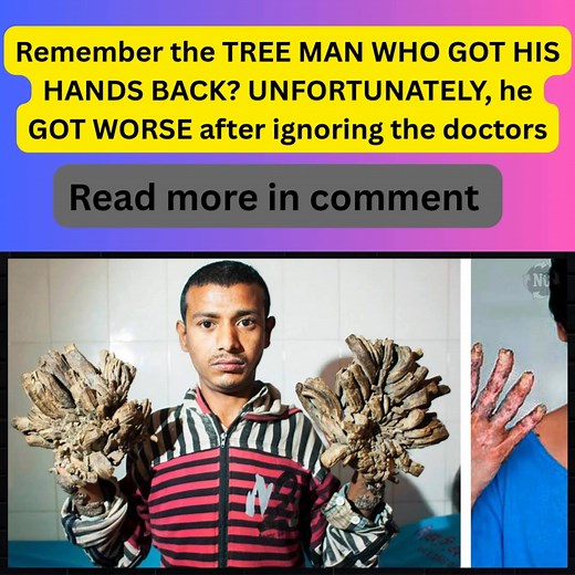 15K views · 50 reactions | Abul Bajandar, the Bangladeshi "Tree Man,"...