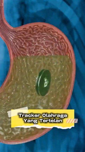 Choking Fitness Tracker #education #feedshort #uniquefacts #interestingfacts #educationalanimation