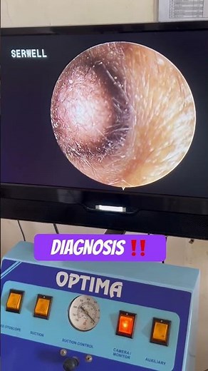 DIAGNOSE THE CASE ‼️ #ayurveda #otorhinolaryngology