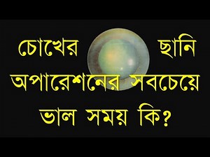 Right time for cataract surgery #cataract #cataractsurgery #cataract surgerytime #cataractlecture