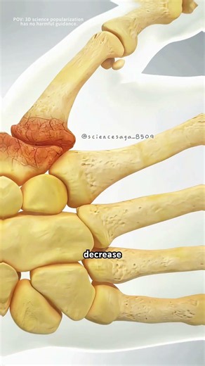 How a tendon can replace trapezium bone in thumb arthritis?(3D animation)#labraltear #thumbarthritis
