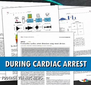 SMART ATTACK: Researchers have developed a system that would allow a smart speaker or smartphone listen for signs of cardiac arrest. The app would issue a warning, then call 911 for help. 8.wfla.com/2IY8FQ1 | WFLA News Channel 8