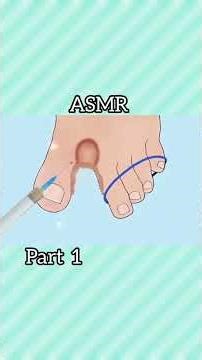 #asmr #asmrtreatment #asmrtreatment #satisfying #satisfyling #satisfyingvideo