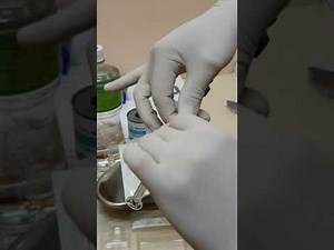 Triptorelin reconstitution by Nurse Carine