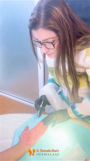 Botox for Hyperhidrosis: The Secret to Sweat-Free Days | Dermalase by Dr. Shumaila Khan