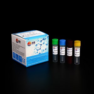 [Hot Item] Ivd PCR Reagents Hepatitis B Virus Detection Kit HBV DNA Detection Kit