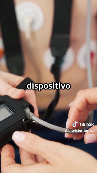 ¿Qué es un Holter y cómo funciona?