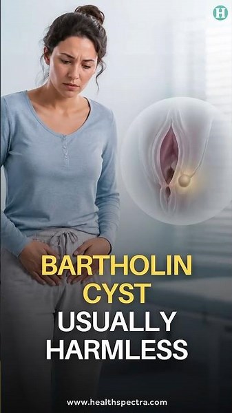 Bartholin Cysts Are Common and Usually Harmless: Here's How to Know