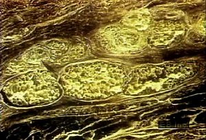 Epidermis, dermis, and fat skin layers | Britannica