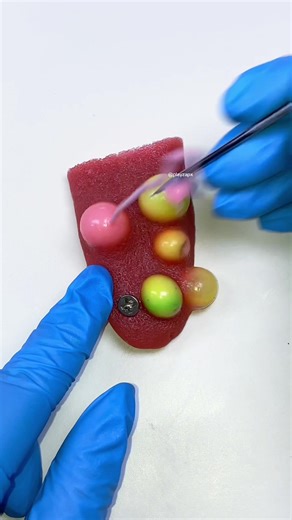 DIY Toy Ideas for Pimple Popping Fun