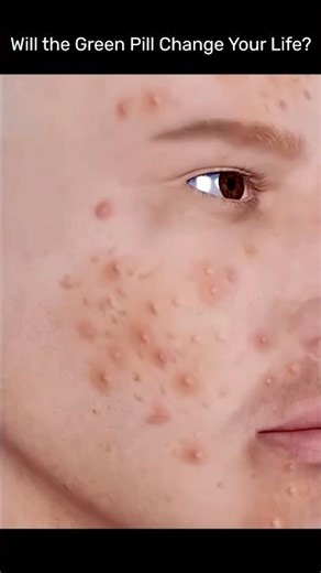 Vitamin E 400 mg: Truth Influencers Don’t Tell You