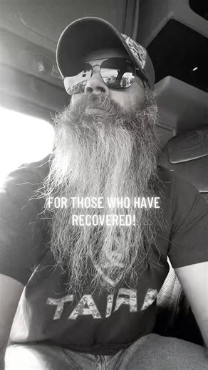 #lizzardlife #lizzardslamed #beardlivesmatter💯 | beard