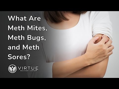 What Are Meth Mites, Meth Bugs, and Meth Sores?