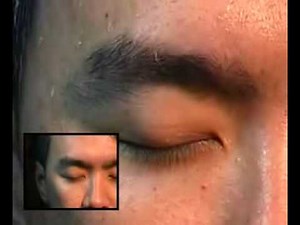 顔から寄生虫が出る。マレーシア pasar malam