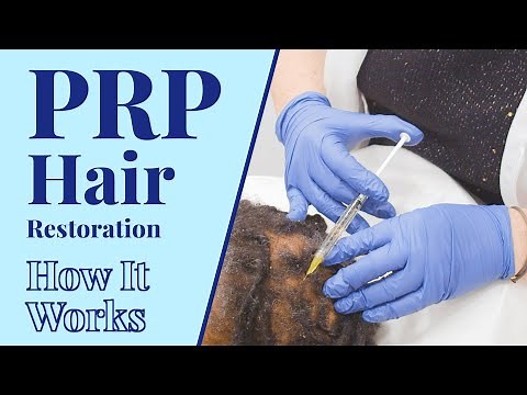 3 Steps of PRP Hair Restoration | BYou Laser Clinic in NYC