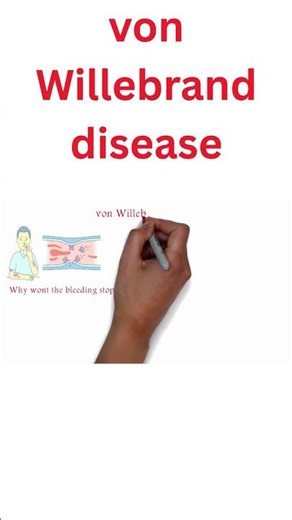 What is Von Willebrand Disease (vWD)?
