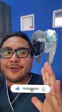 Cómo se curan los granitos de la lengua o las papilas gustativas inflamadas #dentaldom
