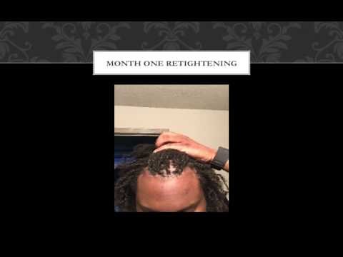 My Brotherlocks Journey (Install through Month 6)