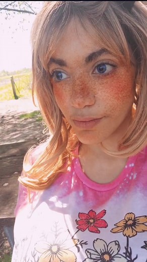 Sunburn 🍋 | sunburn