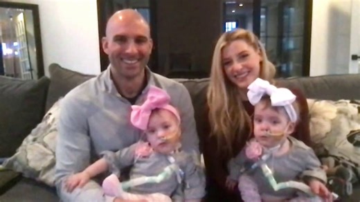 Parents of formerly conjoined twins share their story for first time since separation surgery