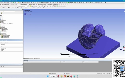 跟骨有限元分析(一)