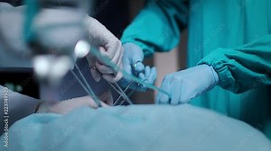 Surgeons operating process. Close up of surgical team performing operation with surgery tools. Medical operation. Surgeons hands working with instruments at surgeon room Stock Video