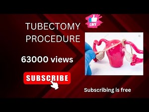 Tubectomy with spinal anaesthesia