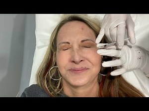 Lip Flip Treatment | Lip Flip Botox Before and After | lip injections vlog 2021 | Jeanee Riley