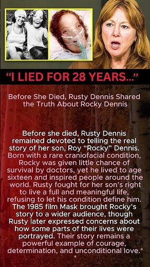 Before She Died, Rusty Dennis Shared the Truth About Rocky Dennis