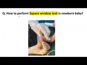 Square Window Test | Newborn Examination | Pediatrics