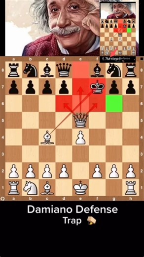 Chass win in best moves: #chasslovers #chass chass gameplay “Chass.com india” GUKESH World champion
