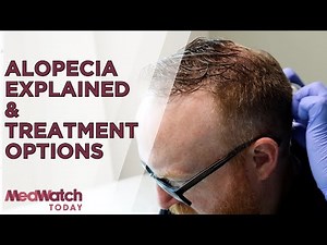 Hair Loss Explained: Treatments & Expert Advice from a Dermatologist