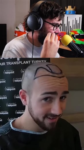 Qui est touché par la calv ? 😶 #BouziTV