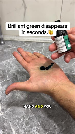 Quick Home Lifehack to Remove Brilliant Green Stains