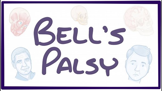 Bell palsy: Video, Causes, & Meaning | Osmosis