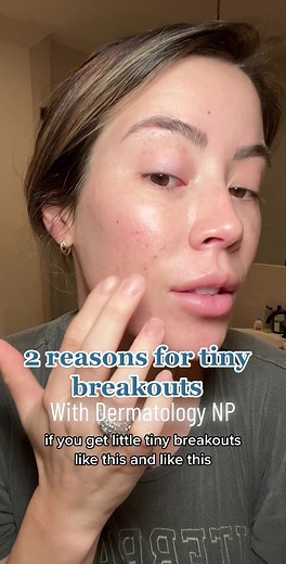Understanding Skin Breakouts: Causes and Solutions