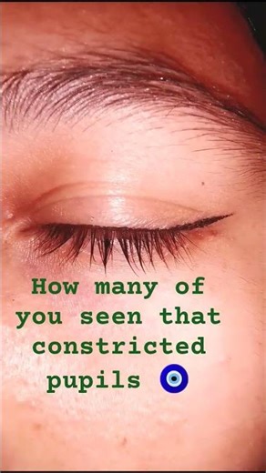 how .any of you seen that constricted pupils #eye