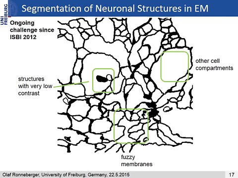 画像セグメンテーション用のアルゴリズム、u-netについて簡単に説明する