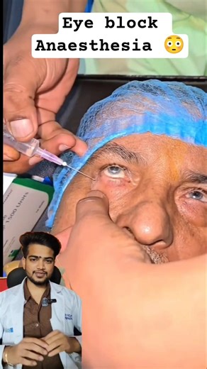 Retrobulbar and Peribulbar block Explained| An eye block Anaesthesia. Only for educational purposes.