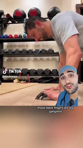 Understanding Gangrene: Causes, Symptoms, and Treatment