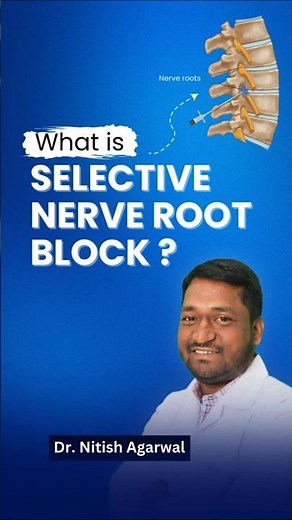 What is Selective Nerve Root Block? 🧠💉 | Dr. Nitish Agarwal (Spine & Orthopedic Specialist)