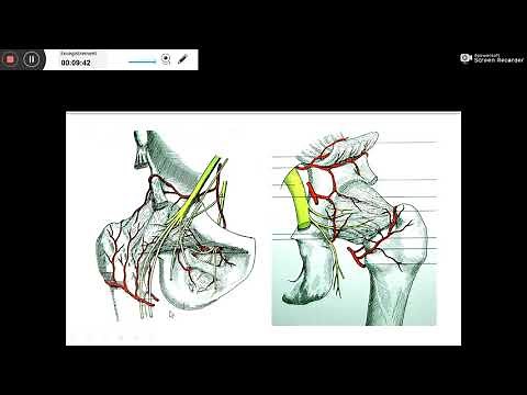 LUXATION DE LA HANCHE