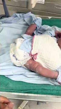 This baby was born with splayed legs, but when doctors discovered...