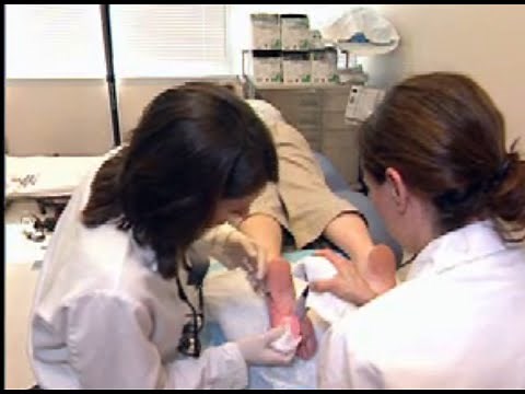 Botox 4 PLANTAR Hyperhidrosis (#sweatyfeet) Dr Dee Anna Glaser, International Hyperhidrosis Society©